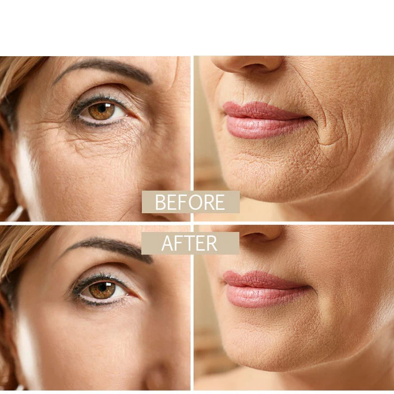 Anti Aging Face Cream With Collagen Hyaluronic Acid And Retinol
