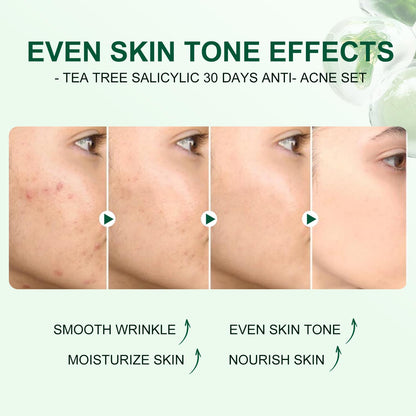 Tea Tree Salicylic Acid Facial Skin Care Set, Acne Treatment Skincare Set