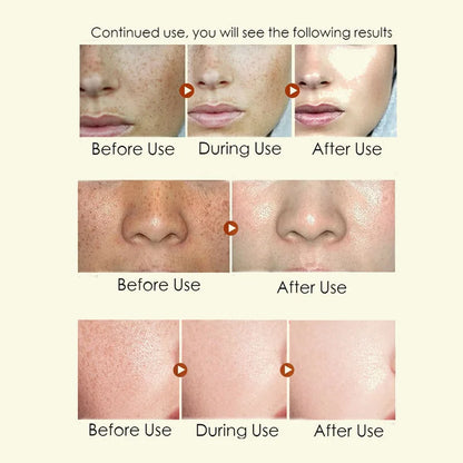 Anti Aging Face Cream With Collagen Hyaluronic Acid And Retinol