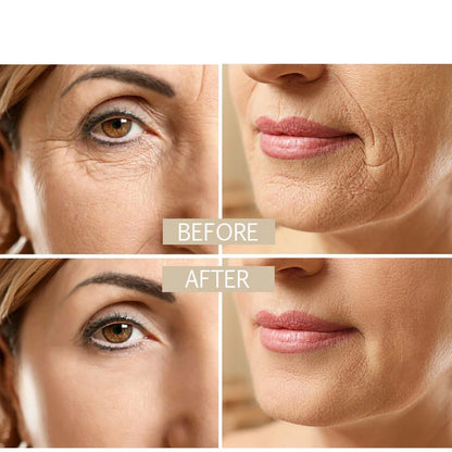 Anti Aging Face Cream With Collagen Hyaluronic Acid And Retinol