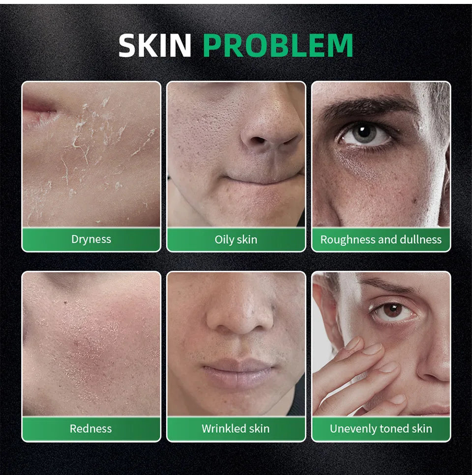 Men Facial Care Kit Face Wash Moisturizer Eye Cream Anti Aging Oil Control