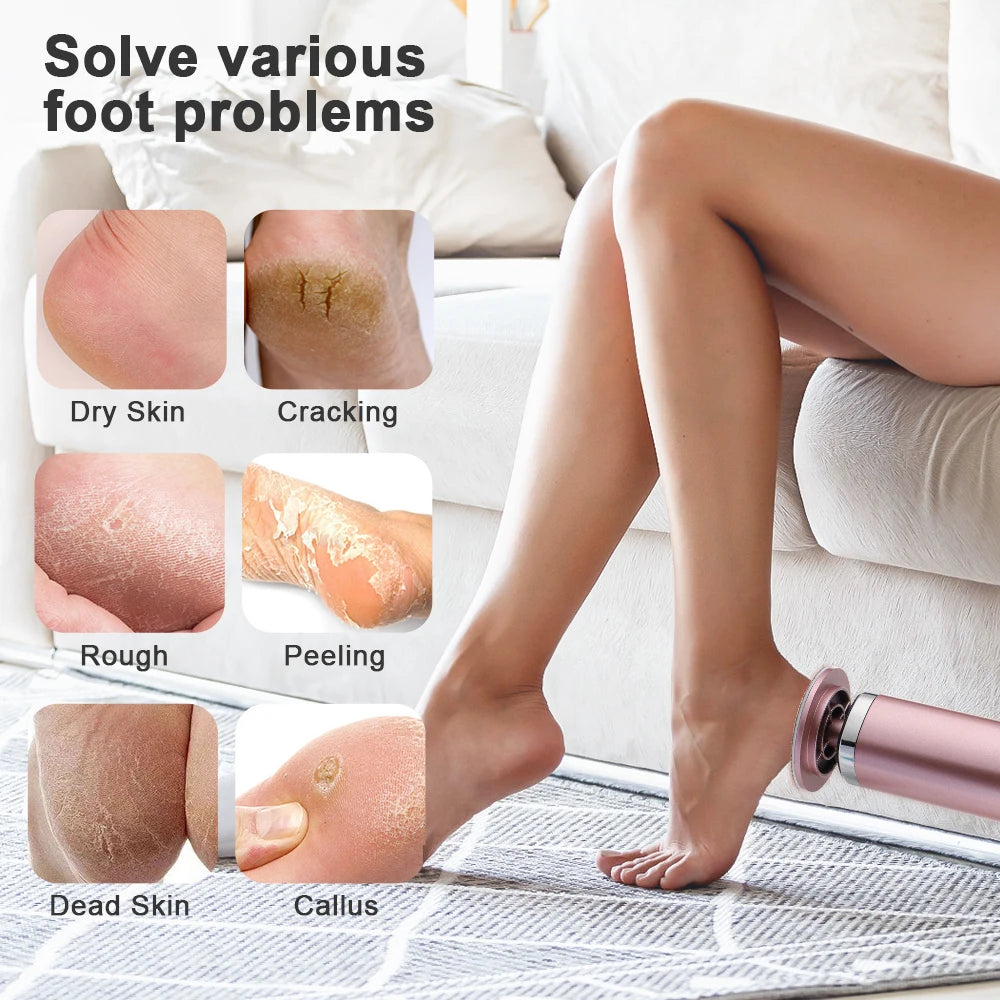 Electric Foot Callus Remover Heels Remove Wireless Rechargeable Foot Care File Cuticle Callus Remover with Replacement Sandpape