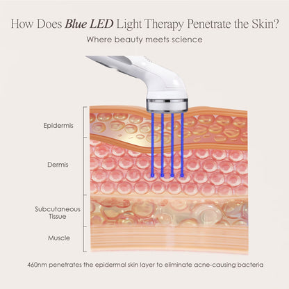 Blue Light Therapy for Acne |Facial Light Therapy Devices for Acne | Anti-Acne Skincare | Reduce Dark Spots &amp; Scars |Remove Blemishes