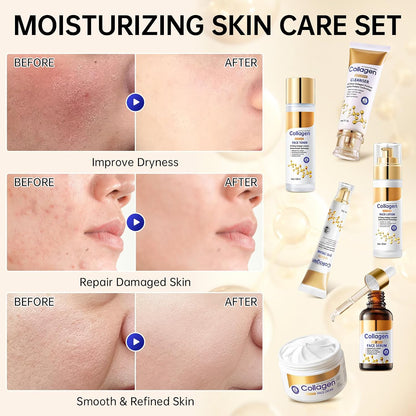 Collagen Skin Care Set, anti Aging Skincare Set for Face, Shrink Pores, Hydrate &amp; Firm Skin, 6 Pcs Individually Packaged Skincare Kits for Women with Cleanser, Toner, Lotion, Serum, Cream, Eye Cream.
