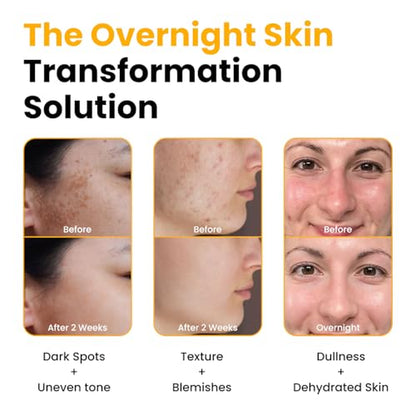 QUIA Collagen Jelly Cream + Turmeric Overnight Wrapping Mask – Daily Hydration and Night Repair Skincare Set – Korean Skincare Moisturizer + Sleeping Mask