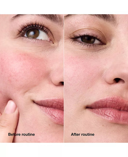 3-Pc. Redness Relief Skincare Set