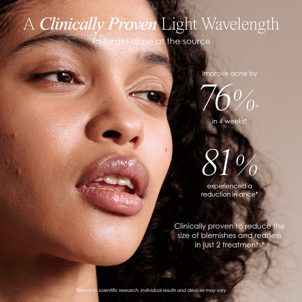 Blue Light Therapy for Acne |Facial Light Therapy Devices for Acne | Anti-Acne Skincare | Reduce Dark Spots &amp; Scars |Remove Blemishes