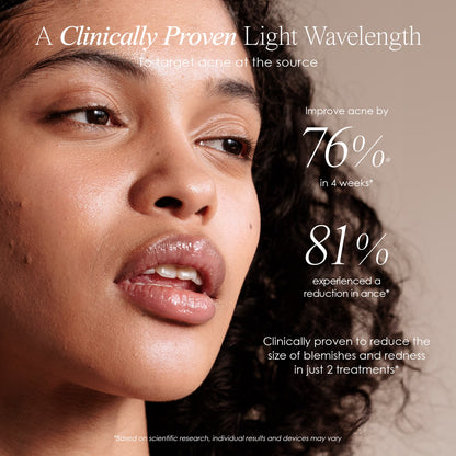 Blue Light Therapy for Acne |Facial Light Therapy Devices for Acne | Anti-Acne Skincare | Reduce Dark Spots &amp; Scars |Remove Blemishes